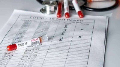 В Казахстане за сутки выявили 164 случая заражения Covid-19 