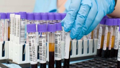 В Актюбинской области больной с Covid-19 скрыл информацию о двоих контактных. Оба заразились