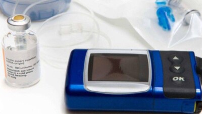 Минздрав обеспечит детей бесплатными инсулиновыми помпами в 2019 году