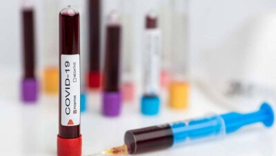 В Москве донорам плазмы с антителами на Covid-19 будут платить до 5000 рублей