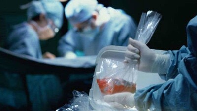 В 2018 году в Алматы не провели ни одну трупную трансплантацию органов