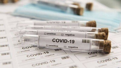 За сутки в Казахстане выявили 184 случая заражения Covid-19, 807 человек выздоровели