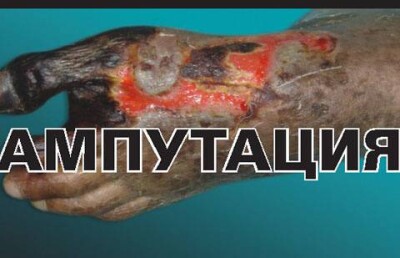 Устрашающие картинки на пачках сигарет напугали казахстанцев - Минздрав РК