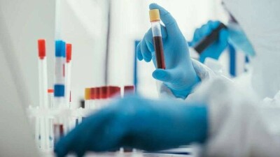 За сутки в Казахстане выявили 1544 случая заражения Covid-19 