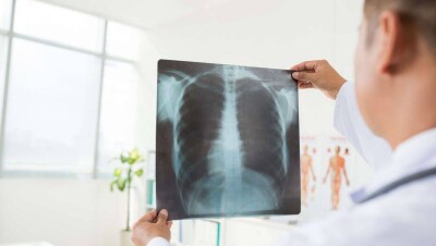 В Казахстане за сутки выявили 307 больных коронавирусной пневмонией 