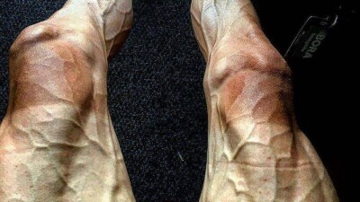 Велогонщик показал свои ноги после 16 этапов "Тур де Франс"