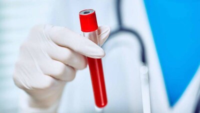 Зарегистрировано ещё пять случаев заражения коронавирусом, два из них в Караганде