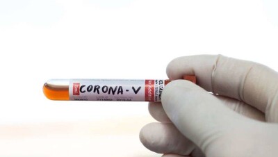 В Казахстане зарегистрировано ещё 20 случаев заражения коронавирусом, 18 из них в Нур-Султане