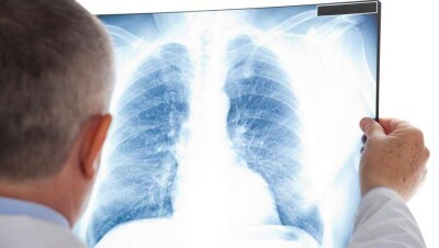  За сутки в Казахстане скончались 30 пациентов с Covid-19 и 18 больных с пневмонией