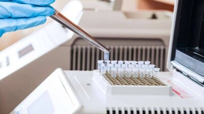 Более полумиллиона ПЦР-тестов по выявлению Covid-19 поступят в РК в течение двух недель