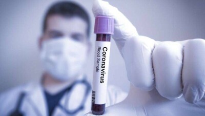 За сутки в Казахстане выявили 77 случаев заражения Covid-19. Нулевой прирост в Шымкенте и четырёх областях