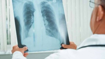 Пневмониядан көз жұмғандар 2 есе артқан. Қазақстан індеттің күзде өршуіне дайын ба?