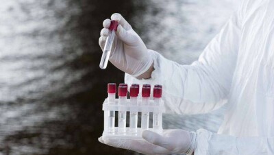 В ВОЗ прокомментировали информацию о новом штамме свиного гриппа в Китае