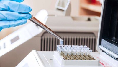 За сутки в Казахстане выявили 175 случаев заражения Covid-19, 1509 человек выздоровели