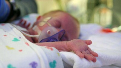 Казахстан улучшил показатели по выхаживанию недоношенных малышей