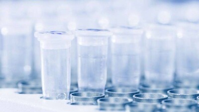 Стоимость ПЦР-теста на Covid-19 в Национальном центре экспертизы снизили до 8025 тенге