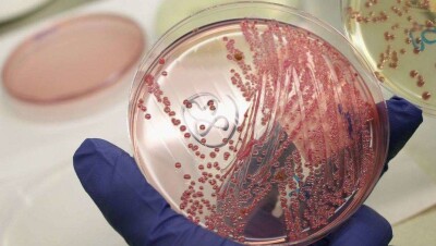 Умерший от сибирской язвы неделю лечился у целительницы и не обращался к врачам