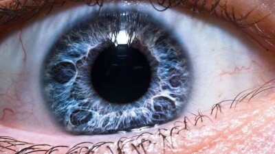 Көз ауруын байқамай, асқындырудың соңы – су қараңғы соқырлық. Алдын ала сақтанамын десеңіз? Дәрігердің кеңесі