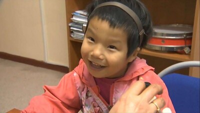 Девочке без ушных раковин вернули слух после уникальной операции в Алматы