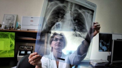 У студентов двух вузов Алматы выявили открытую форму туберкулёза