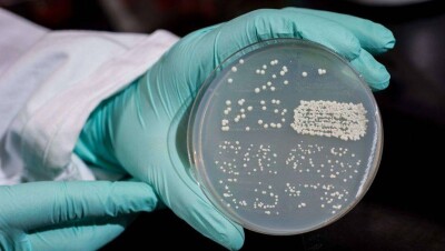 Пятый случай холеры выявили медики у вернувшегося из Гоа алматинца