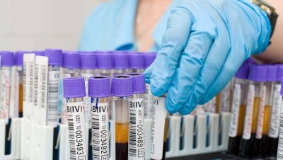 Суд обязал Минздрав изменить правила, ограничивающие конкуренцию в проведении анализов на ВИЧ