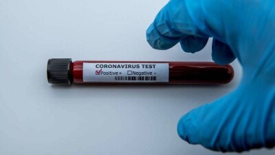 Количество заражённых Covid-19 в Казахстане превысило 4000 человек