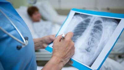 В Минздраве объяснили, почему число выздоровевших пациентов с пневмонией за день выросло на 20 тысяч человек