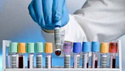 Минздрав отрицает, что отказал в регистрации отечественного чудо-лекарства против рака 