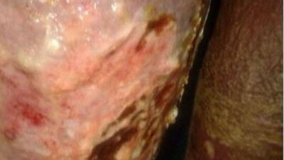 В Шымкенте скончалась женщина, которой ранее отказали в медицинской помощи