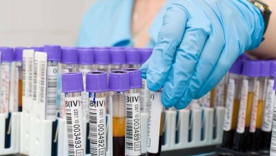 Из-за отсутствия ПЦР-справок у водителей на границе с РФ образовался затор. Там установят лабораторию