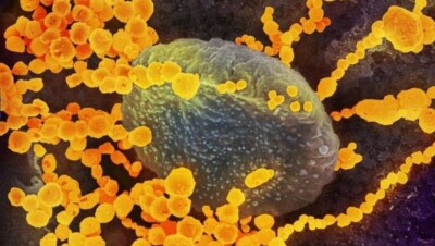 Когда сделают вакцину от коронавируса: хороший, плохой и "злой" сценарии 