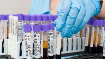 В Минздраве считают нецелесообразным проводить массовые ПЦР-исследования среди педагогов