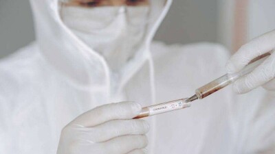22 қыркүйекте Қазақстанда коронавирус жұқтырған 76 адам тіркелді