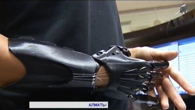 В Алматы 20-летней работнице фитнес-центра напечатали протез руки на принтере