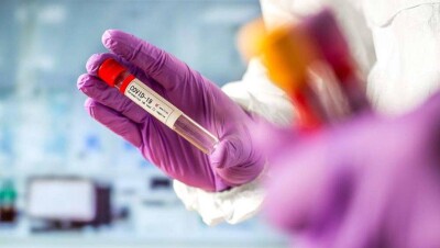 Бесплатные тесты на Covid-19 предоставят уязвимым категориям граждан в Нур-Султане и Алматы