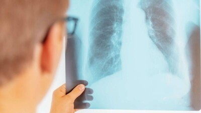 В Казахстане за сутки выявили 483 больных с коронавирусной пневмонией 