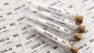 Число заражённых коронавирусом в Казахстане превысило 80 000 человек 