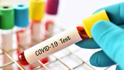 Covid-19 в мире: Италия откроет границы 3 июня, в Украине будут проводить массовое тестирование 