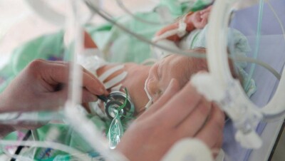 Ребёнок с четырьмя ногами родился в Индии