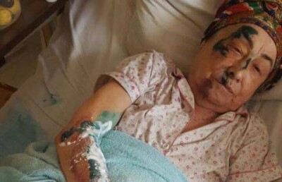 Алматинцы разыскивают водителя джипа, сбившего во дворе пенсионерку