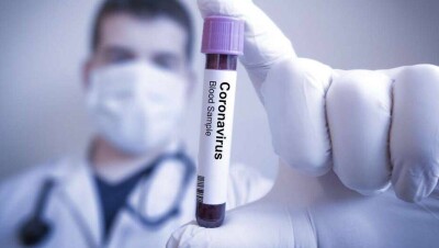 За сутки в Казахстане выявили 476 случаев заражения Covid-19, 1877 человек выздоровели