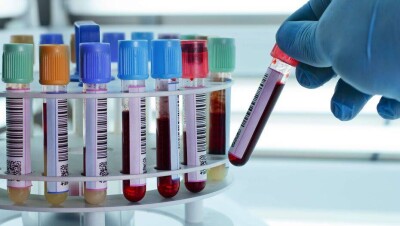 Лаборатории "Олимп" выявили антитела к коронавирусу у 62% протестированных казахстанцев