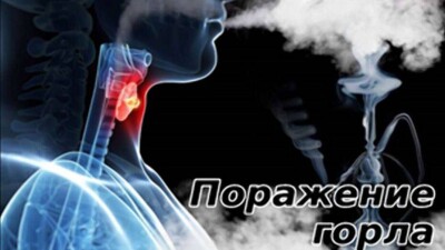 Минздрав разработал эскизы, предупреждающие о вреде сигарет и кальянов