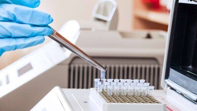 За сутки в Казахстане выявили 78 случаев заражения Covid-19, 155 человек выздоровели