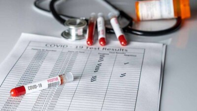 За сутки в Казахстане выявили 72 случая заражения Covid-19, 472 человека выздоровели