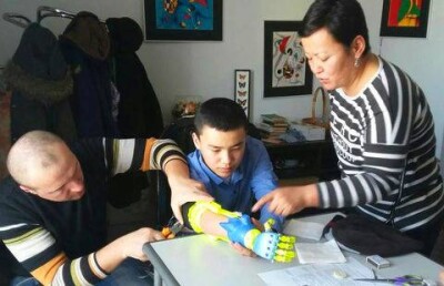 Подростку из ВКО "напечатали" новую руку