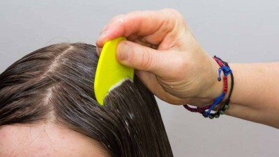 Мать умершего после обработки от педикулёза ребёнка использовала препарат для скота