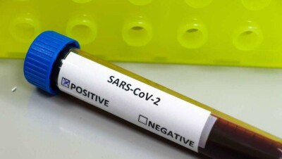 Число заражённых коронавирусом в Казахстане выросло до 70