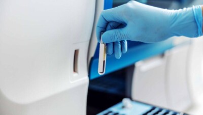 ВОЗ объединила случаи атипичной пневмонии и коронавируса в Казахстане в одну статистику 